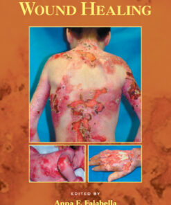 Wound Healing 1st Edition - Original PDF