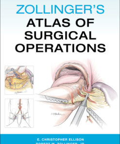 Zollinger's Atlas of Surgical Operations 11th Edition - Original PDF