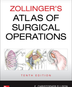 Zollinger's Atlas of Surgical Operations 10th Edition - Original PDF
