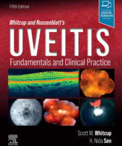 Whitcup and Nussenblatt's Uveitis: Fundamentals and Clinical Practice 5th Edition - Original PDF