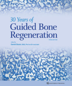 30 Years of Guided Bone Regeneration 3rd Edition - Original PDF