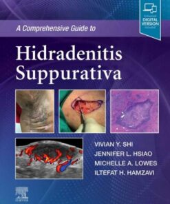 A Comprehensive Guide to Hidradenitis Suppurativa - Original PDF